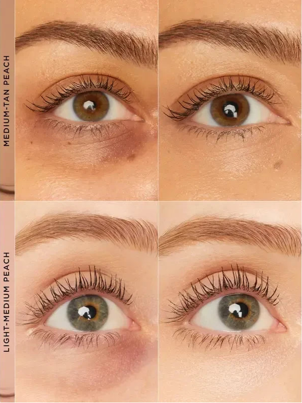 Svedalyn™ CC Undereye Corrector